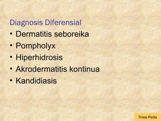 Diagnosis Diferensial
• Dermatitis seboreika
• Pompholyx
• Hiperhidrosis
• Akrodermatitis kontinua
• Kandidiasis
Tinea Pedis
 