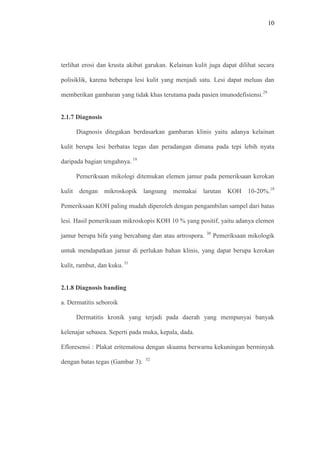 10
terlihat erosi dan krusta akibat garukan. Kelainan kulit juga dapat dilihat secara
polisiklik, karena beberapa lesi kulit yang menjadi satu. Lesi dapat meluas dan
memberikan gambaran yang tidak khas terutama pada pasien imunodefisiensi.29
2.1.7 Diagnosis
Diagnosis ditegakan berdasarkan gambaran klinis yaitu adanya kelainan
kulit berupa lesi berbatas tegas dan peradangan dimana pada tepi lebih nyata
daripada bagian tengahnya. 18
Pemeriksaan mikologi ditemukan elemen jamur pada pemeriksaan kerokan
kulit dengan mikroskopik langsung memakai larutan KOH 10-20%.18
Pemeriksaan KOH paling mudah diperoleh dengan pengambilan sampel dari batas
lesi. Hasil pemeriksaan mikroskopis KOH 10 % yang positif, yaitu adanya elemen
jamur berupa hifa yang bercabang dan atau artrospora. 30
Pemeriksaan mikologik
untuk mendapatkan jamur di perlukan bahan klinis, yang dapat berupa kerokan
kulit, rambut, dan kuku. 31
2.1.8 Diagnosis banding
a. Dermatitis seboroik
Dermatitis kronik yang terjadi pada daerah yang mempunyai banyak
kelenajar sebasea. Seperti pada muka, kepala, dada.
Efloresensi : Plakat eritematosa dengan skuama berwarna kekuningan berminyak
dengan batas tegas (Gambar 3). 32
 