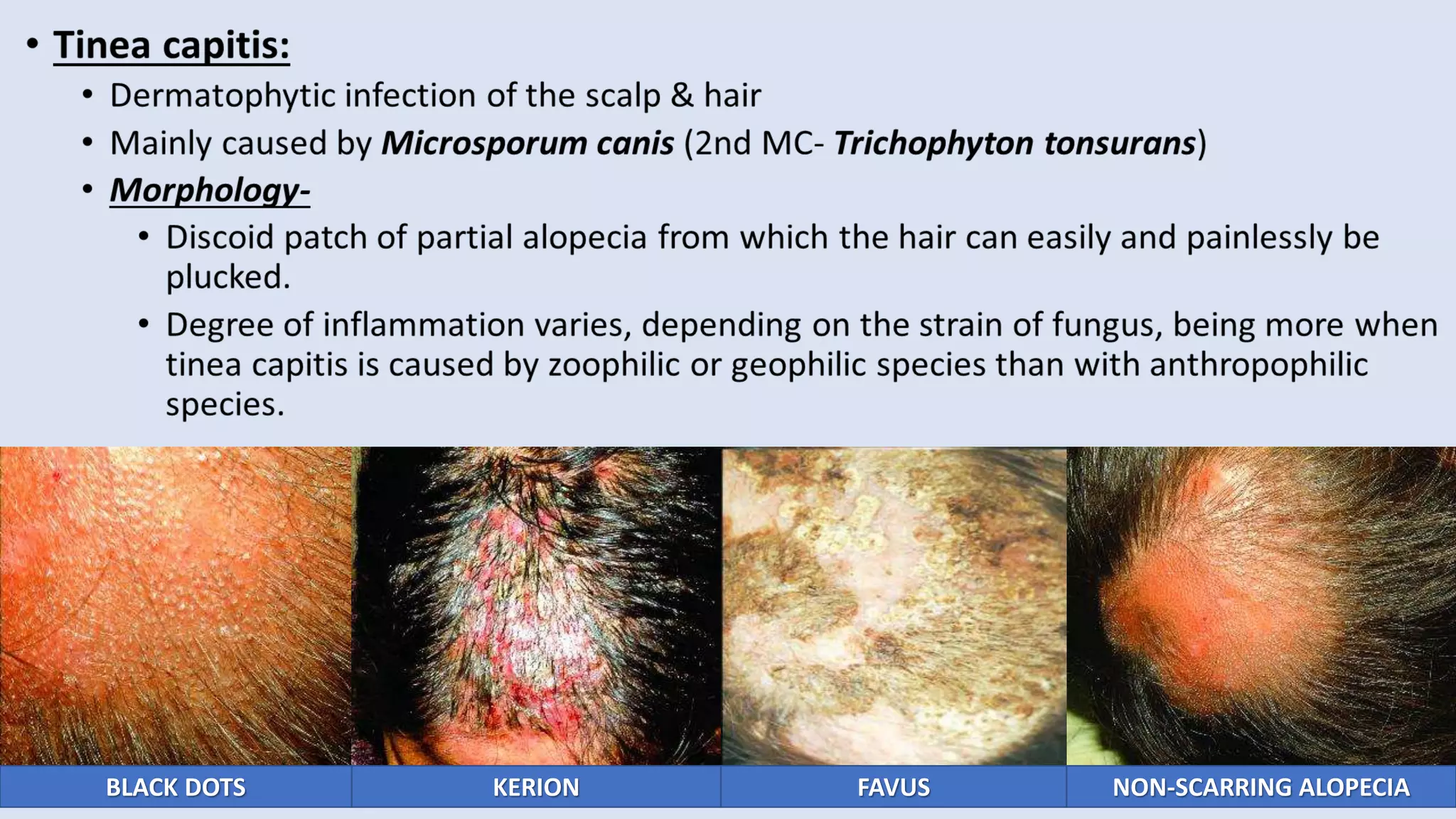 BLACK DOTS NON-SCARRING ALOPECIA
KERION FAVUS