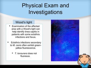 Physical Exam and
Investigations
 Examination of the affected
area with a Wood's light can
help identify tinea capitis in
patients with some ectothrix
infections and favus.
 Ectothrix infections secondary
to M. canis often exhibit green-
yellow fluorescence.
 T. tonsurans does not
fluoresce.
Wood’s light
 