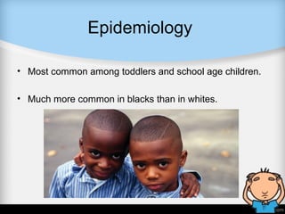 Epidemiology
• Most common among toddlers and school age children.
• Much more common in blacks than in whites.
 