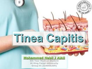 Tinea Capitis
Mohammed Nabil J AlAli
5th Year Medical Student
At King Faisal University
Powerpoint Templates
Group B (210006209)

Page 1

 