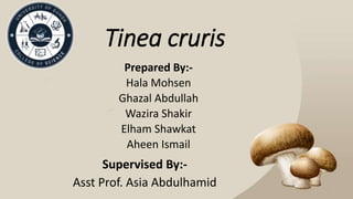 Tinea cruris
Prepared By:-
Hala Mohsen
Ghazal Abdullah
Wazira Shakir
Elham Shawkat
Aheen Ismail
Supervised By:-
Asst Prof. Asia Abdulhamid
 