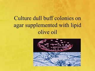 tinea versicolour.pdf