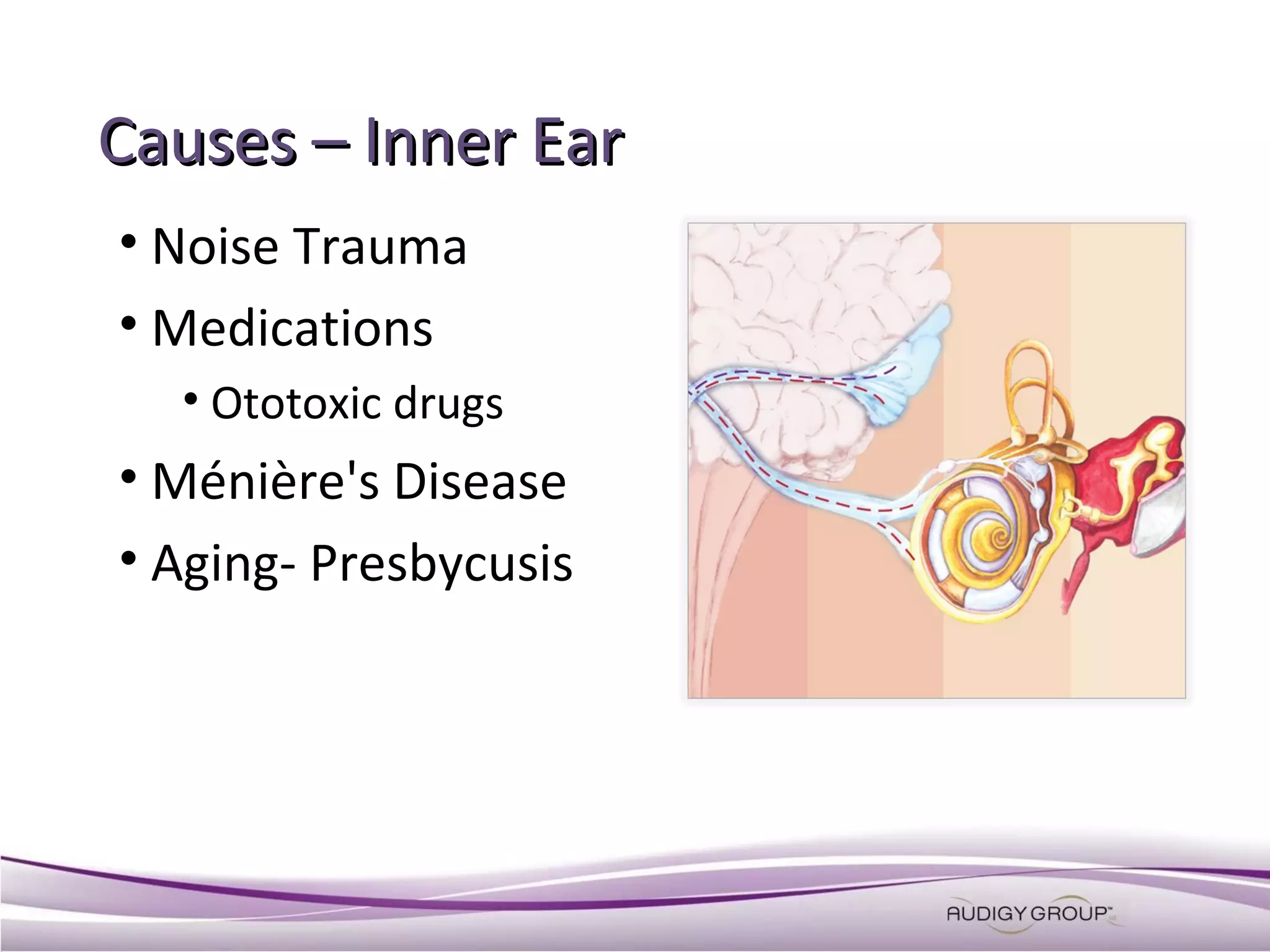 Causes – Inner Ear
• Noise Trauma
• Medications
• Ototoxic drugs

• Ménière's Disease
• Aging- Presbycusis

 