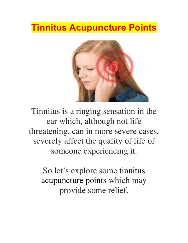 Tinnitus Acupuncture Points