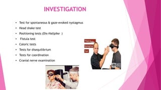 INVESTIGATION
• Test for spontaneous & gaze-evoked nystagmus
• Head shake test
• Positioning tests (Dix-Hallpike )
• Fistula test
• Caloric tests
• Tests for disequilibrium
• Tests for coordination
• Cranial nerve examination
 