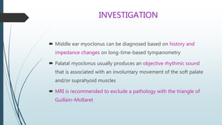INVESTIGATION
 Middle ear myoclonus can be diagnosed based on history and
impedance changes on long-time-based tympanometry
 Palatal myoclonus usually produces an objective rhythmic sound
that is associated with an involuntary movement of the soft palate
and/or suprahyoid muscles
 MRI is recommended to exclude a pathology with the triangle of
Guillain–Mollaret
 