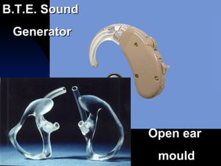 Ear Generators Tinnitus retraining therapy | PPT