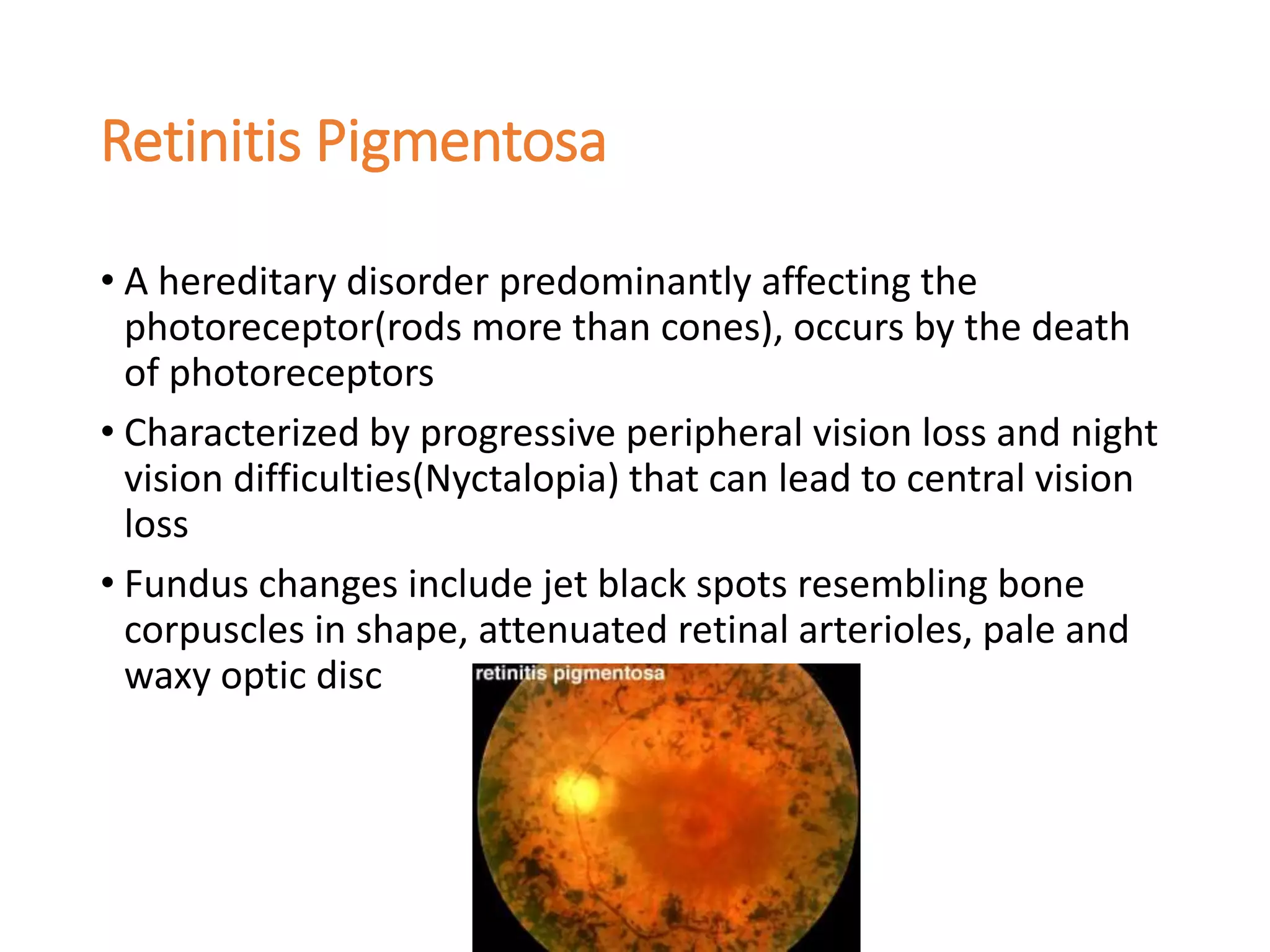 Retinitis Pigmentosa
• A hereditary disorder predominantly affecting the
photoreceptor(rods more than cones), occurs by the death
of photoreceptors
• Characterized by progressive peripheral vision loss and night
vision difficulties(Nyctalopia) that can lead to central vision
loss
• Fundus changes include jet black spots resembling bone
corpuscles in shape, attenuated retinal arterioles, pale and
waxy optic disc
 