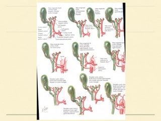 Tip and technique for safe LC | PDF
