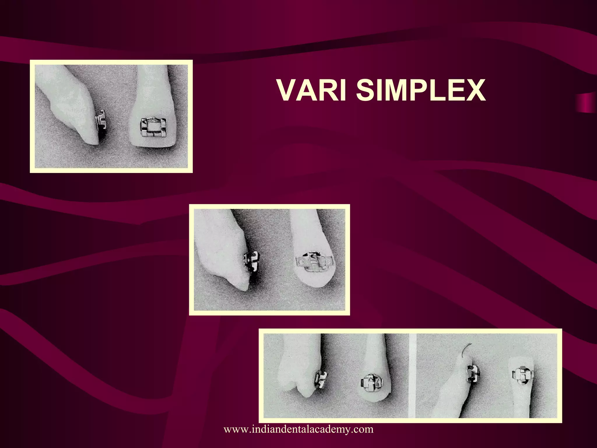 VARI SIMPLEX
www.indiandentalacademy.com
 