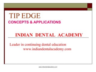 TIP EDGE
CONCEPTS & APPLICATIONS

INDIAN DENTAL ACADEMY
Leader in continuing dental education
www.indiandentalacademy.com

www.indiandentalacademy.com

 
