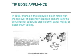 TIP EDGE APPLIANCE
In 1986, change in the edgewise slot is made with
the removal of diagonally opposed corners from the
conventional edgewise slot to permit either mesial or
distal crown tipping.
www.indiandentalacademy.com
 