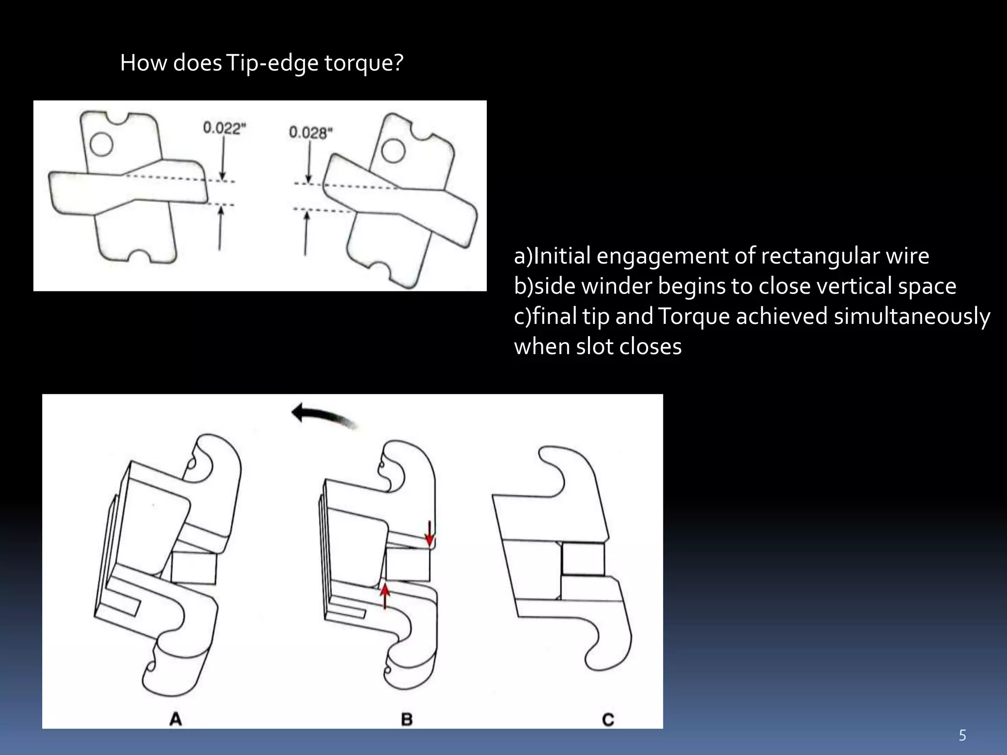 Tip Alignment Tip edge orthodontics stage III | PDF