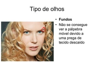 Tipo de olhos
• Fundos
• Não se consegue
ver a pálpebra
móvel devido a
uma prega de
tecido descaído

 
