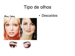 Tipo de olhos
• Descaídos

 