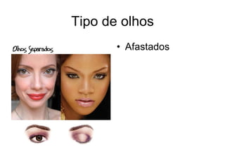 Tipo de olhos
• Afastados

 