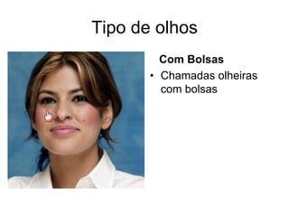 Tipo de olhos
Com Bolsas
• Chamadas olheiras
com bolsas

 