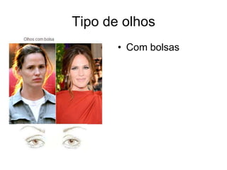 Tipo de olhos
• Com bolsas

 