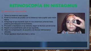 RETINOSCOP A EN NISTAGMUS
Í
C). METODO DE DISOCIACIÓN
1. Tomar la distancia naso-pupilar.
2. Poner la montura de prueba con la distancia naso-pupilar para visión
lejana.
3. Anteponga al ojo izquierdo (que no va a examinar) prismas base
externa para bloquear el movimiento.
4. Proceder a neutralizar el ojo derecho según la técnica convencional.
5. Repetir el procedimiento para el ojo izquierdo.
6. Hacer la compensación de acuerdo a la técnica retinoscópica
utilizada.
7. Tomar agudeza visual para lejos y cerca.
 