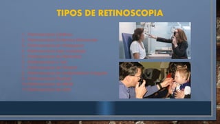 TIPOS DE RETINOSCOPIA
1. Retinoscopía Estática
2. Retinoscopía Dinámica Monocular
3. Retinoscopía en Nistagmus
4. Retinoscopía bajo cicloplejia
5. Retinoscopía de Mohindra
6. Retinoscopía e Tait
7. Retinoscopía de Sheard
8. Retinoscopía en astigmatismo Irregular
9. Retinoscopía Radical
10.Retinoscopía de MEM
11.Retinoscopía de Nott
 