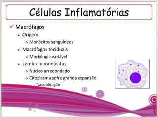 Células Inflamatórias
 Macrófagos
► Origem
 Monócitos sanguíneos
► Macrófagos teciduais
 Morfologia variável
► Lembram monócitos
 Núcleo arredondado
 Citoplasma sofre grande expansão
– Vacuolização
 