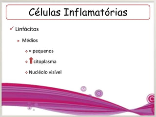 Células Inflamatórias
 Linfócitos
► Médios
 ≈ pequenos
 citoplasma
 Nucléolo visível
 