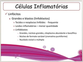 Células Inflamatórias
 Linfócitos
► Grandes e blastos (linfoblastos)
 Tecidos e neoplasias linfóides - frequente
 Lesões inflamatórias – menor quantidade
 Linfoblastos
– Grandes, núcleos grandes, citoplasma abundante e basofílica
– Núcleo de formato variável (cromatina puntiforme)
– Nucléolo visível e múltiplo
 