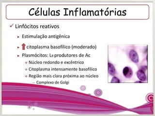 Células Inflamatórias
 Linfócitos reativos
► Estimulação antigênica
► citoplasma basofílico (moderado)
► Plasmócitos: LB produtores de Ac
 Núcleo redondo e excêntrico
 Citoplasma intensamente basofílico
 Região mais clara próxima ao núcleo
– Complexo de Golgi
 