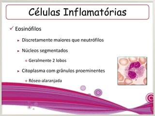 Células Inflamatórias
 Eosinófilos
► Discretamente maiores que neutrófilos
► Núcleos segmentados
 Geralmente 2 lobos
► Citoplasma com grânulos proeminentes
 Róseo-alaranjada
 