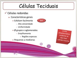 Células Teciduais
 Células redondas
► Características gerais
 Esfoliam facilmente
– Alta celularidade
– Uniformidade
 Ø grupos e aglomerados
– Empilhamento
» Regiões espessas
 Pequenas a medianas
BAF
 