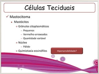 Células Teciduais
 Mastocitoma
► Mastócitos
 Grânulos citoplasmáticos
– Pequenos
– Vermelho-arroxeados
– Quantidade variável
 Núcleo
– Pálido
 Quimiotaxia eosinófilos Raros a abundantesHipersensibilidade?
 