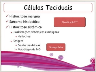 Células Teciduais
 Histiocitose maligna
 Sarcoma histiocítico
 Histiocitose sistêmica
► Proliferações sistêmicas e malignas
 Histiócitos
► Origem
 Células dendríticas
 Macrófagos da MO
Classificação???
Citologia falha
 