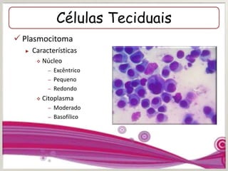 Células Teciduais
 Plasmocitoma
► Características
 Núcleo
– Excêntrico
– Pequeno
– Redondo
 Citoplasma
– Moderado
– Basofílico
 