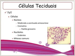 Células Teciduais
 TVT
► Células
 Núcleos
– Moderada a acentuada anisocariose
– Cromatina
» Padrão grosseiro
 Nucléolos
– Evidentes
 Mitoses comuns
 