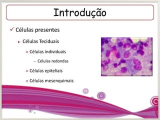 Introdução
 Células presentes
► Células Teciduais
 Células individuais
– Células redondas
 Células epiteliais
 Células mesenquimais
 