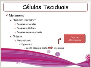 Células Teciduais
 Melanoma
► “Grande imitador”
 Células redondas
 Células epiteliais
 Células mesenquimais
► Origem
 Melanócitos
– Pigmentos
» Verde-escuro a preto melanina
Grau de
diferenciação
 