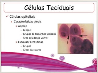 Células Teciduais
 Células epiteliais
► Características gerais
 Adesão
– Lençóis
– Grupos de tamanhos variados
– Área de adesão visível
 Examinar áreas finas
– Grupos
– Áreas acelulares
 