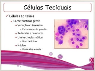 Células Teciduais
 Células epiteliais
► Características gerais
 Variação no tamanho
– Extremamente grandes
 Redondas a colunares
 Limite citoplasmático
– Bem definido
 Núcleo
– Redondos a ovais
 