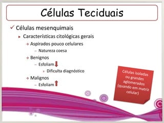 Células Teciduais
 Células mesenquimais
► Características citológicas gerais
 Aspirados pouco celulares
– Natureza coesa
 Benignos
– Esfoliam
» Dificulta diagnóstico
 Malignos
– Esfoliam
 
