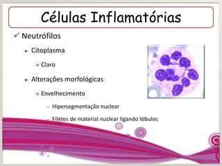 Células Inflamatórias
 Neutrófilos
► Citoplasma
 Claro
► Alterações morfológicas
 Envelhecimento
– Hipersegmentação nuclear
– Filetes de material nuclear ligando lóbulos
 
