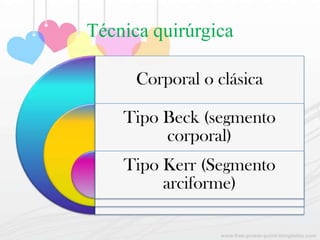 Tipos cesáreas | PPTX