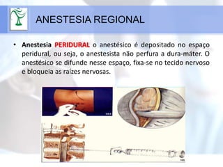 • Anestesia PERIDURAL o anestésico é depositado no espaço
peridural, ou seja, o anestesista não perfura a dura-máter. O
anestésico se difunde nesse espaço, fixa-se no tecido nervoso
e bloqueia as raízes nervosas.
ANESTESIA REGIONAL
 