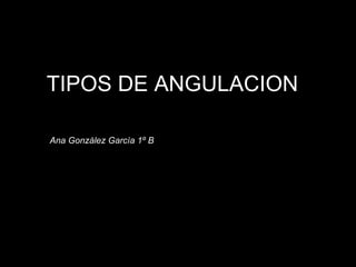 TIPOS DE ANGULACION Ana González García 1º B  