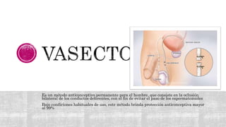 Es un método anticonceptivo permanente para el hombre, que consiste en la oclusión
bilateral de los conductos deferentes, con el fin de evitar el paso de los espermatozoides
Bajo condiciones habituales de uso, este método brinda protección anticonceptiva mayor
al 99%
 
