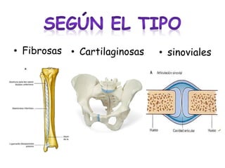 • Fibrosas • Cartilaginosas

• sinoviales

 