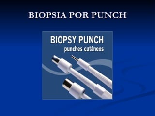 BIOPSIA POR PUNCH