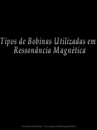 Tipos de Bobinas Utilizadas em Ressonância Magnética Alex Eduardo Ribeiro - Tecnólogo em Radiologia Médica 