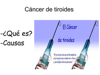 Cáncer de tiroides
-¿Qué es?
-Causas
 